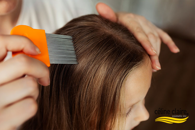 How Do You Dry Scalp Treatment