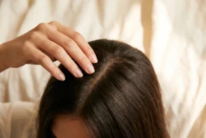 Dandruff Treatment: What to Use and When to Get Help